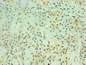 SIRT3 Antibody