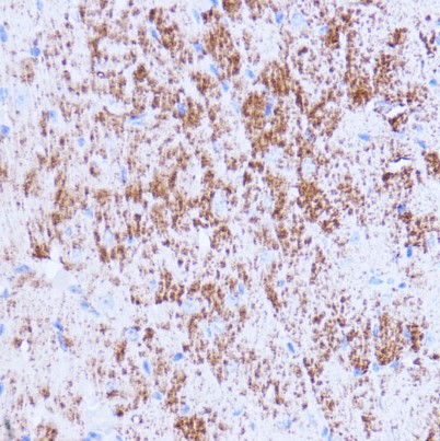 SIRT3 polyclonal antibody