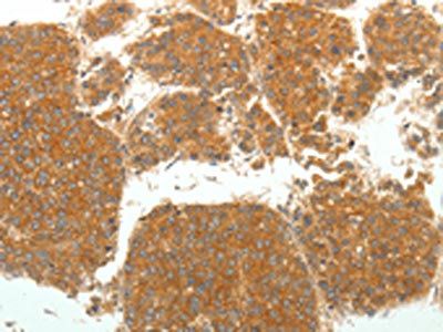 SIRT4 Antibody