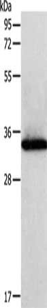 SIRT4 antibody