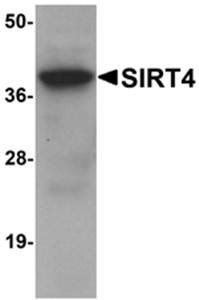 SIRT4 Polyclonal Antibody