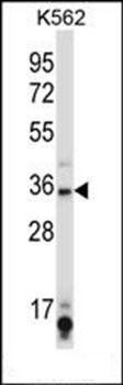 SIRT6 antibody