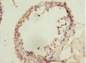 SIVA1 Antibody