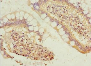 SIVA1 Antibody