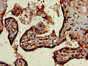 SKIL Antibody
