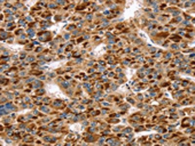 SKIL Antibody