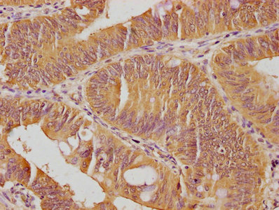 SKOR2 Antibody