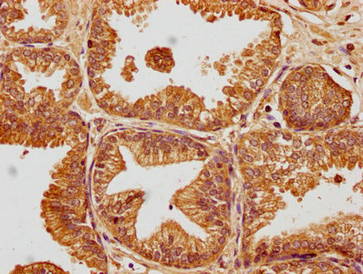 SKOR2 Antibody
