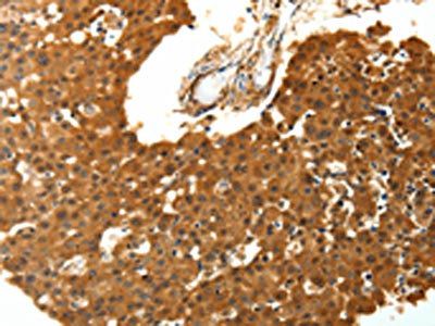 SKP1 Antibody