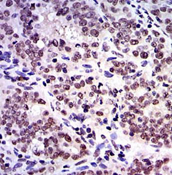 SKP1 Antibody