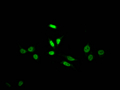 SKP2 Recombinant Monoclonal Antibody