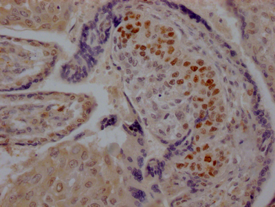 SKP2 Recombinant Monoclonal Antibody