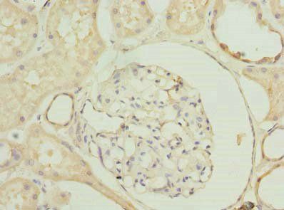 SLA Antibody