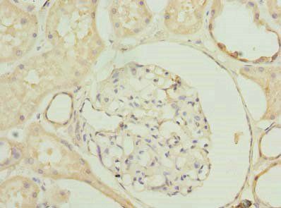 SLA antibody