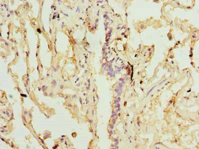 SLA Antibody