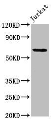 SLAIN1 Antibody