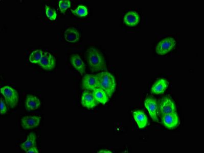 SLC10A2 Antibody