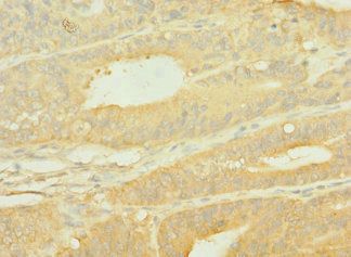 SLC10A2 Antibody