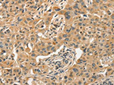 SLC11A2 Antibody