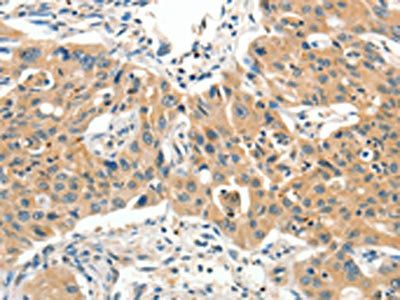 SLC11A2 Antibody
