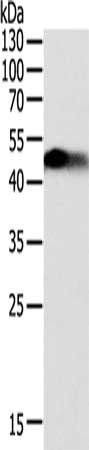 SLC12A1 Antibody