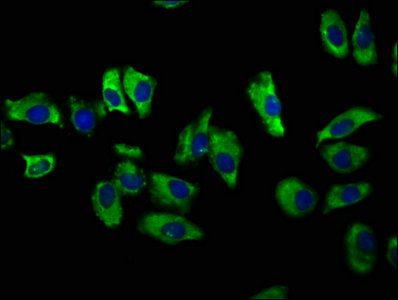 SLC12A2 Antibody