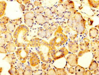 SLC12A2 Antibody