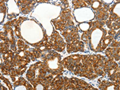 SLC12A4 Antibody
