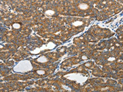 SLC12A4 Antibody