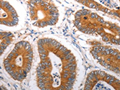 SLC12A6 Antibody