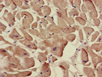 SLC12A7 Antibody