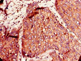 SLC12A7 Antibody