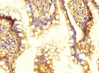 SLC13A2 Antibody