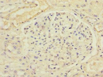 SLC13A2 Antibody