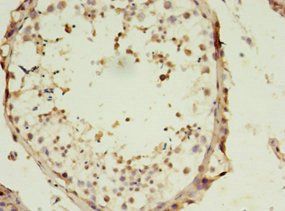 SLC13A4 Antibody