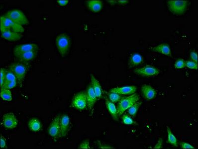 SLC13A5 Antibody