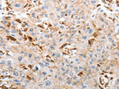 SLC15A2 Antibody