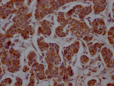 SLC16A1 Recombinant Monoclonal Antibody