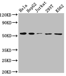 SLC16A1 Recombinant Monoclonal Antibody