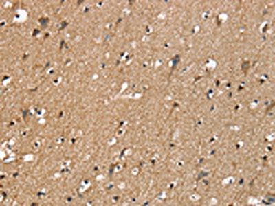 SLC16A10 Antibody