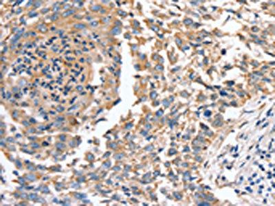 SLC16A10 Antibody