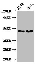 SLC16A11 antibody