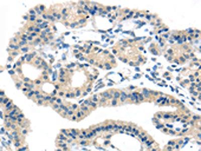 SLC16A11 Antibody