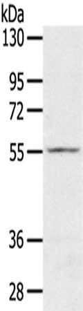 SLC16A11 antibody