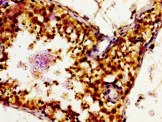 SLC16A12 antibody