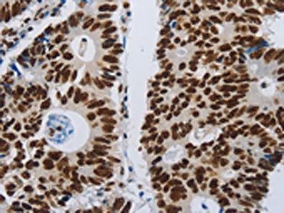 SLC16A14 Antibody