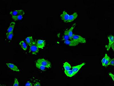 SLC16A3 Antibody