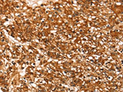 SLC16A3 Antibody
