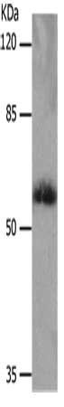 SLC16A4 antibody