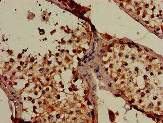 SLC16A7 Antibody